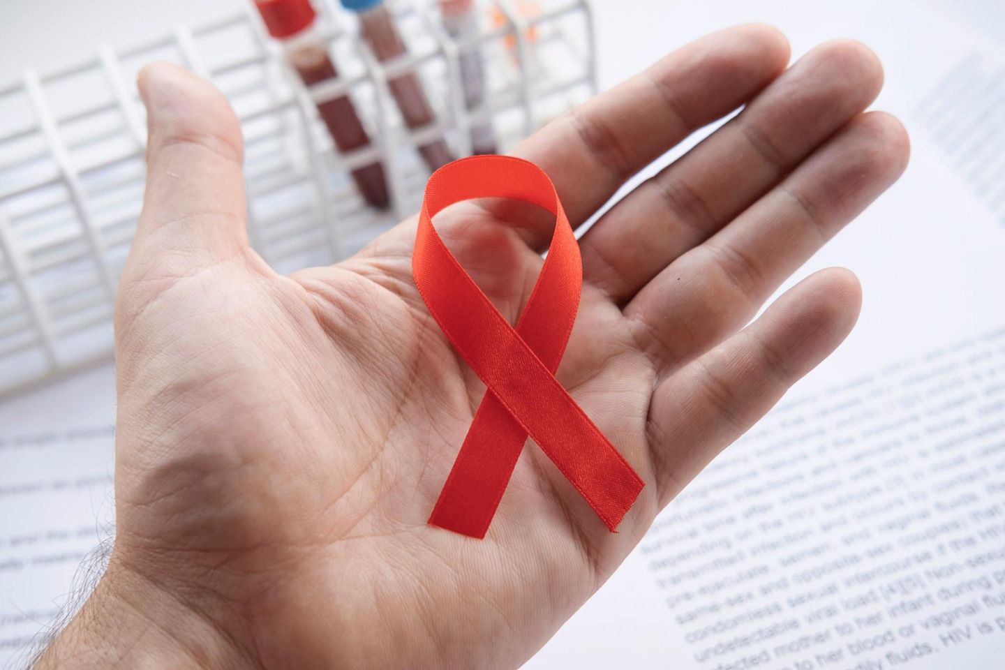 Afinal, você sabe qual é a diferença entre HIV e AIDS? Veja aqui!